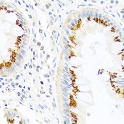 ABclonal Technology&nbsp;FAM3B Rabbit pAb