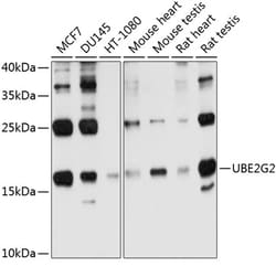 ABclonal Technology&nbsp;UBE2G2 Rabbit pAb