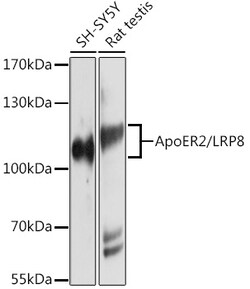 ABclonal Technology&nbsp;ApoER2/LRP8 Rabbit pAb