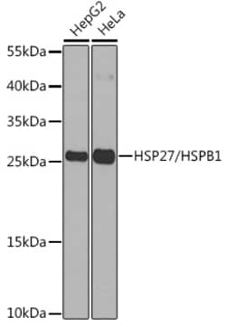 ABclonal Technology&nbsp;HSP27/HSPB1 Rabbit pAb