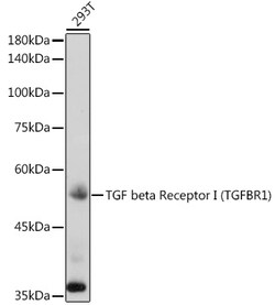 ABclonal Technology&nbsp;TGF beta Receptor I (TGFBR1) Rabbit pAb