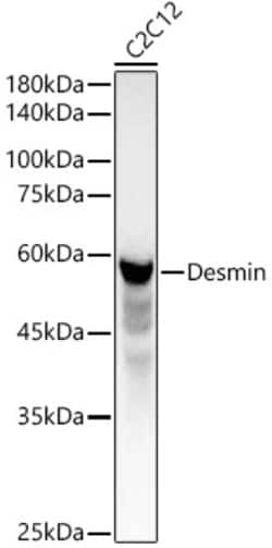 ABclonal Technology&nbsp;Desmin Rabbit pAb