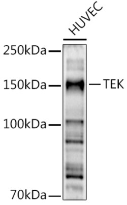 ABclonal Technology&nbsp;TEK Rabbit pAb