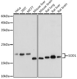 ABclonal Technology&nbsp;SOD1 Rabbit pAb