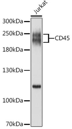 ABclonal Technology&nbsp;CD45 Rabbit pAb