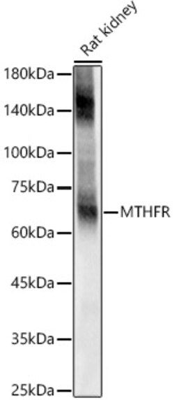 ABclonal Technology EAAT2/SLC1A2 Rabbit pAb, Quantity: Each of 1