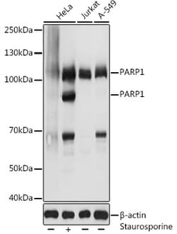 ABclonal Technology&nbsp;PARP1 Rabbit pAb