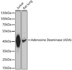 ABclonal Technology&nbsp;Adenosine Deaminase (ADA) Rabbit pAb