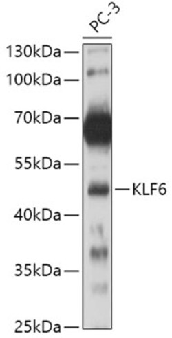 ABclonal Technology&nbsp;KLF6 Rabbit pAb