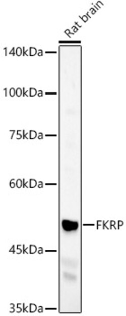 ABclonal Technology&nbsp;FKRP Rabbit pAb