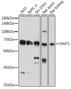 ABclonal Technology&nbsp;DMT1/SLC11A2 Rabbit pAb