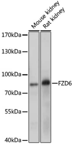 ABclonal Technology&nbsp;FZD6 Rabbit pAb