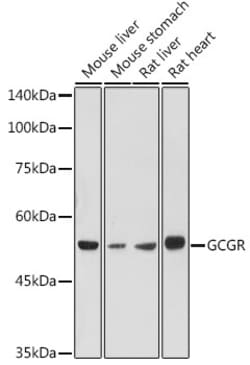 ABclonal Technology&nbsp;GCGR Rabbit pAb