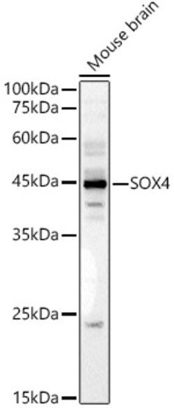 ABclonal Technology&nbsp;SOX4 Rabbit pAb