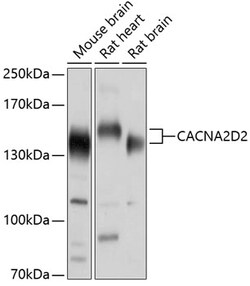 ABclonal Technology&nbsp;CACNA2D2 Rabbit pAb