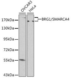 ABclonal Technology&nbsp;[KO Validated] BRG1/SMARCA4 Rabbit pAb