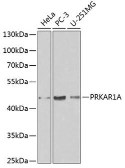 ABclonal Technology&nbsp;[KO Validated] PRKAR1A Rabbit pAb