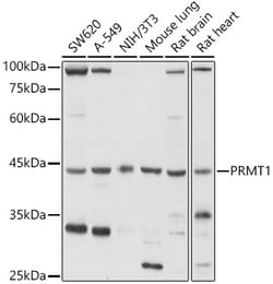 ABclonal Technology&nbsp;PRMT1 Rabbit pAb