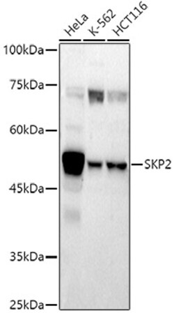 ABclonal Technology&nbsp;SKP2 Rabbit pAb