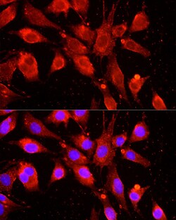 ABclonal Technology&nbsp;cIAP1 Rabbit pAb