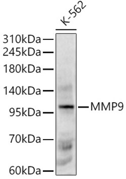 ABclonal Technology&nbsp;MMP9 Rabbit pAb
