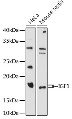 ABclonal Technology&nbsp;IGF1 Rabbit pAb
