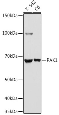 ABclonal Technology&nbsp;PAK1 Rabbit pAb