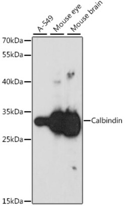 ABclonal Technology&nbsp;Calbindin Rabbit pAb