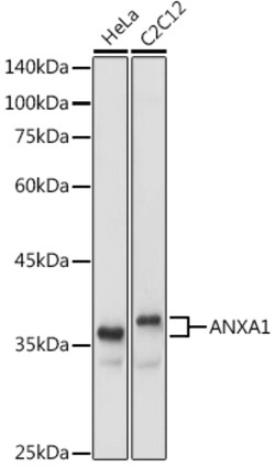 ABclonal Technology&nbsp;ANXA1 Rabbit pAb
