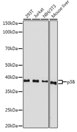 ABclonal Technology p38 MAPK Rabbit pAb, Quantity: Each of 1