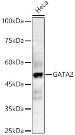 ABclonal Technology&nbsp;GATA2 Rabbit pAb
