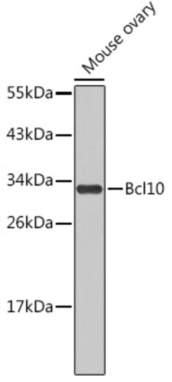ABclonal Technology&nbsp;Bcl10 Rabbit pAb