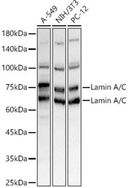 ABclonal Technology&nbsp;Lamin A/C Rabbit pAb