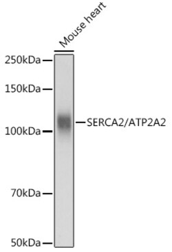 ABclonal Technology&nbsp;SERCA2/ATP2A2 Rabbit pAb