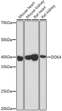 ABclonal Technology&nbsp;DOK4 Rabbit pAb