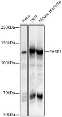 ABclonal Technology&nbsp;PARP1 Rabbit pAb