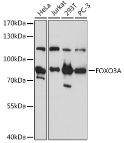 ABclonal Technology&nbsp;FOXO3A Rabbit pAb