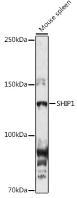 ABclonal Technology&nbsp;SHIP1 Rabbit pAb