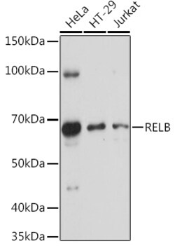 ABclonal Technology&nbsp;RELB Rabbit pAb