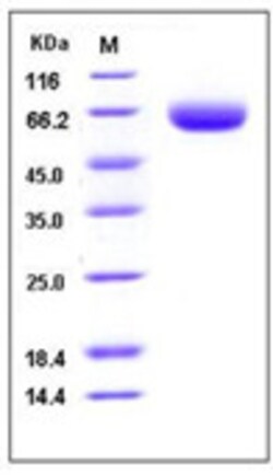 Sino Biological Recombinant Mouse BACE1 Protein (His Tag), Quantity: Each