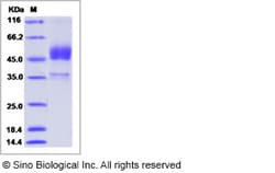 Sino Biological Recombinant Mouse BMPRIB Protein (hFc Tag), Quantity: Each