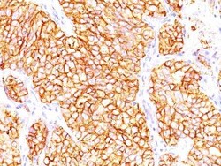 Biotium Renal Cell Carcinoma (Carbonic Anhydrase IX)(66.4.C2), CF740 conjugate,