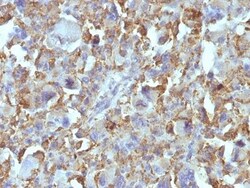 Biotium Small Cell Lung Cancer (SCLC)(MOC-52), CF740 conjugate, 0.1mg/mL,