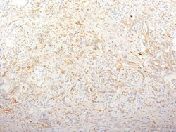 Biotium Fibronectin(TV-1), CF740 conjugate, 0.1mg/mL, Quantity: Each of