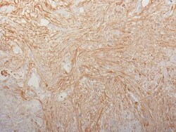 Biotium Fibronectin(HFN7.1), CF740 conjugate, 0.1mg/mL, Quantity: Each