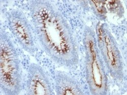 Biotium CD66 (CEA)(C66/261), CF740 conjugate, 0.1mg/mL, Quantity: Each
