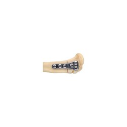 Med Vet International&nbsp;Tibial Wedge Osteotomy Plate, 6-holes, 26mm, 2.0mm Screws, J0822D, Each