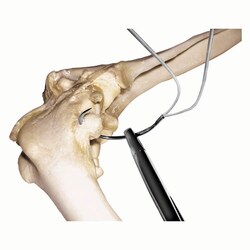 Med Vet International&nbsp;Double Line and Needle, 800mm x 2 Line. 80 lb./Small Needle, J0710MD