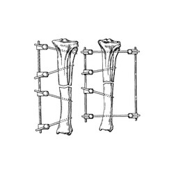 Med Vet International&nbsp;Medium Fixation Type II Kit, Medium IM Pin, 1/8” x 9” Rod, 8”L, J0371KBM, 1 Kit