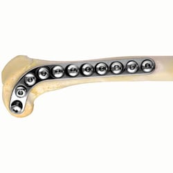 Med Vet International&nbsp;Distal Femur Plate, J0428P, 50mm, Left, 2mm Holes, Each